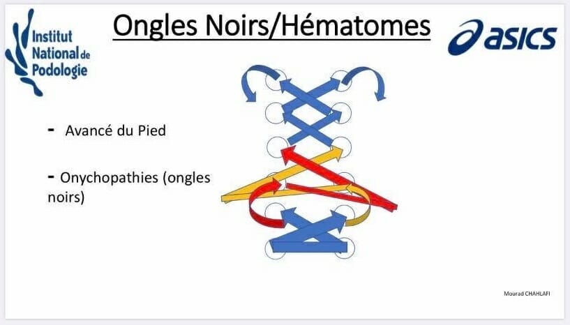 ongles_noir_fiche_explicative